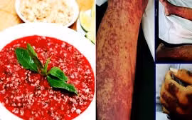 Hai người ở Đắk Lắk mắc bệnh liên cầu lợn do ăn tiết canh 