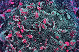 Covid-19 tăng liên tục, Bộ Y tế yêu cầu khẩn giám sát biến thể mới của SARS-CoV-2 