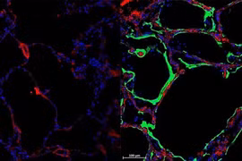 Phát hiện ra loại protein mới có thể ngăn chặn virus SARS-CoV-2 