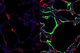 Phát hiện ra loại protein mới có thể ngăn chặn virus SARS-CoV-2 