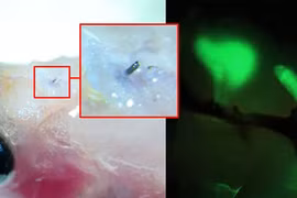 Thử nghiệm liệu pháp mới điều trị rối loạn thần kinh