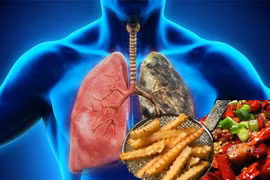 5 loại thực phẩm gây hại cho phổi