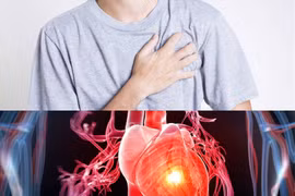 Góc tư vấn: Bệnh tim có di truyền không?