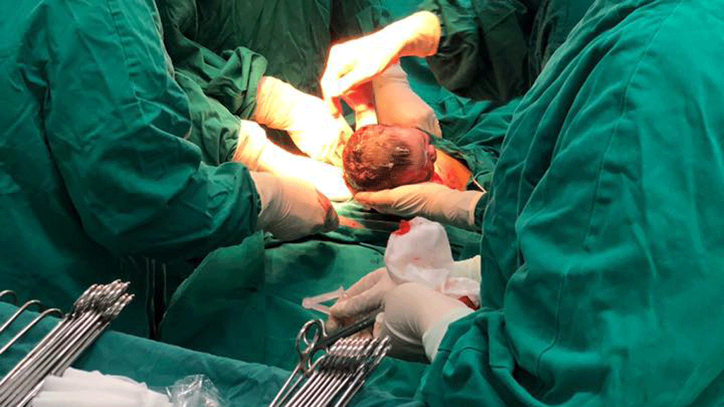  Bé Đàm Thị Phương Mai cất tiếng khóc chào đời lúc 0 giờ 3 phút ngày 1.1.2019 bằng phương pháp sinh mổ