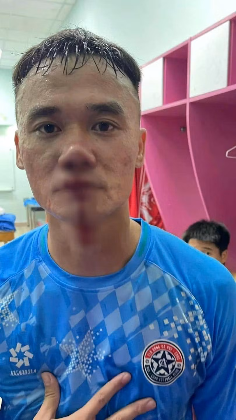 Xuân Nam