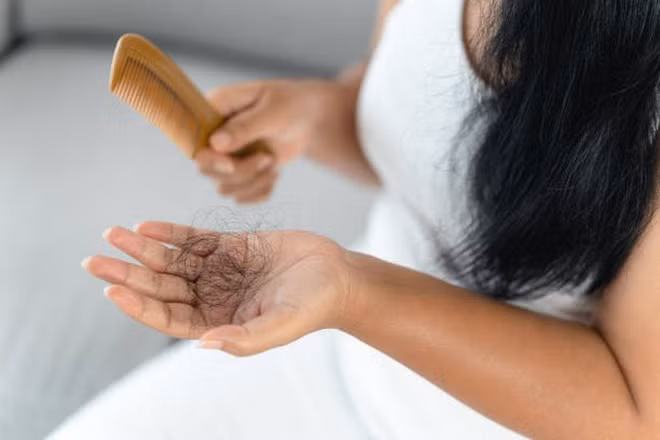 Thiếu protein là một trong những nguyên nhân phổ biến gây rụng tóc. (Ảnh: iStock)
