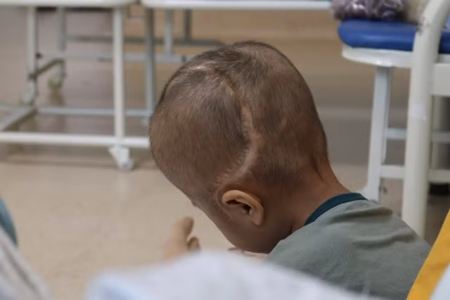 Vết sẹo của cháu Hân thành hình sau cuộc đại phẫu