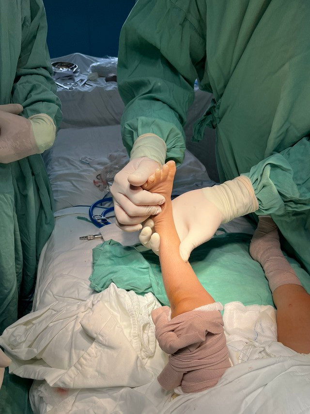 Đôi chân bệnh nhi đang dần hồi phục sau ca phẫu thuật. Ảnh: Thanh Xuân