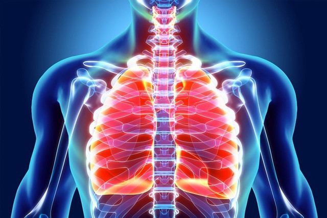 Ung thư phổi là một loại ung thư thường gặp