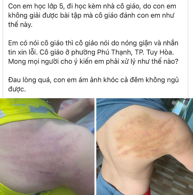 Trang mạng xã hội đăng tải nội dung phản ánh học sinh lớp 5 đi học kèm bị đánh. Ảnh: Chụp màn hình