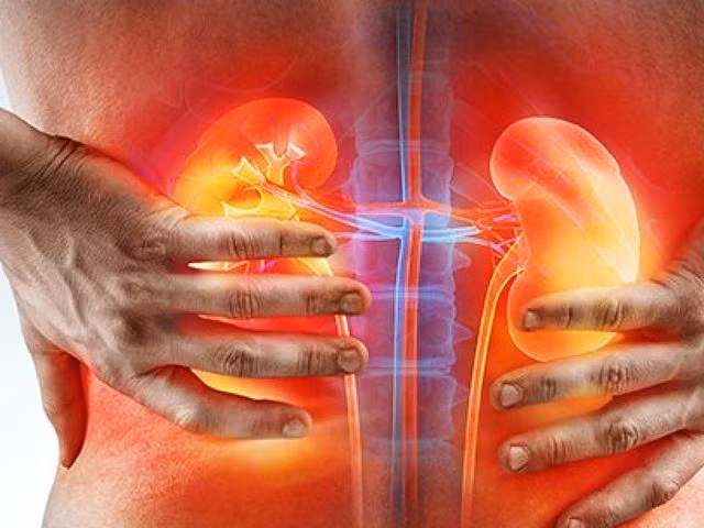 Đau lưng do sỏi thận thường đau nhiều hơn một số cơn đau lưng khác