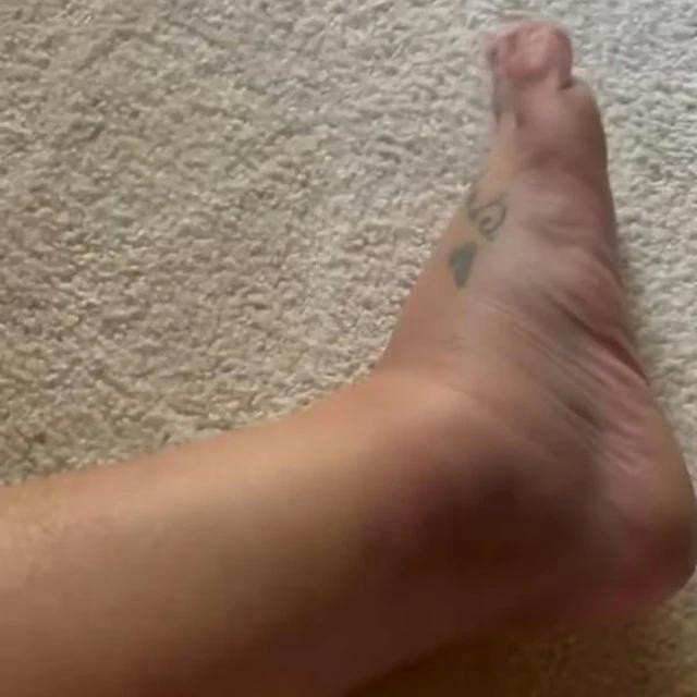 Britney khẳng định cô đã ngã khi cố gắng thực hiện một bước nhảy vọt trong phòng của mình chứ không có một vụ ẩu đả nào xảy ra Britney khẳng định cô đã ngã khi cố gắng thực hiện một bước nhảy vọt trong phòng của mình chứ không có một vụ ẩu đả nào xảy ra