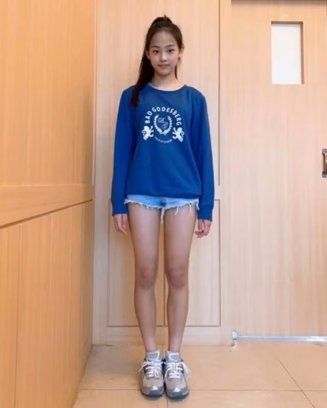 Phần đông mọi người đều cho rằng Minji xinh đẹp từ bé: "Có người nói rằng cô ấy đã phẫu thuật thẩm mỹ nhưng nhìn Minji bây giờ và ngày xưa vẫn giống nhau đó thôi" hay "Cô ấy xinh đẹp và trông giống hệt như hồi còn đi học". Nhờ những "bằng chứng thép" này nên tin đồn việc chị cả NewJeans từng động chạm "dao kéo" đã dần trở thành dĩ vãng