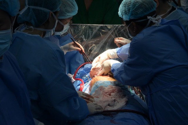 Các bác sĩ tiến hành ca ghép phổi Các bác sĩ tiến hành ca ghép phổi