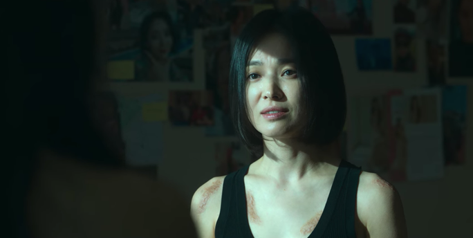 Song Hye-kyo trong "The Glory" với cơ thể đầy sẹo do bị bạo lực học đường Song Hye-kyo trong "The Glory" với cơ thể đầy sẹo do bị bạo lực học đường