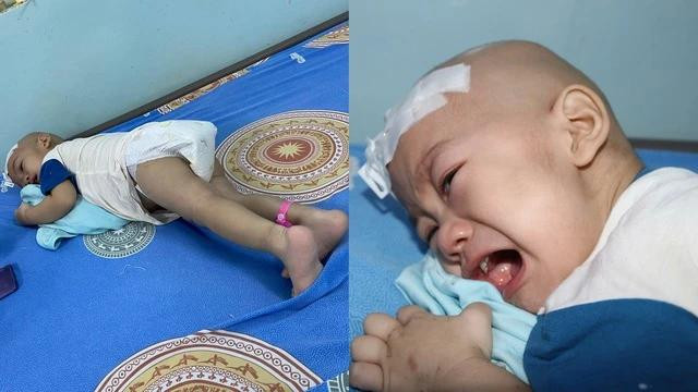 Tư thế nằm "chữa cơn đau" của Phát Tư thế nằm "chữa cơn đau" của Phát