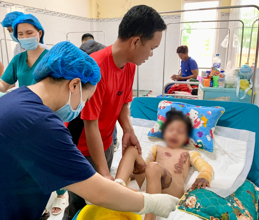 Tai nạn thương tích ở trẻ em có chiều hướng gia tăng trong những ngày vừa qua. Ảnh: Như Nguyện Tai nạn thương tích ở trẻ em có chiều hướng gia tăng trong những ngày vừa qua. Ảnh: Như Nguyện