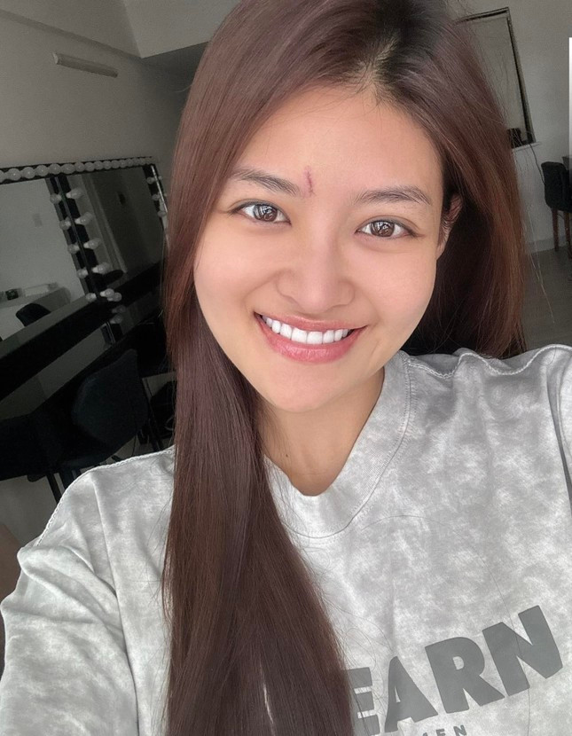 Thùy Anh bị chấn thương trong quá trình quay phim.