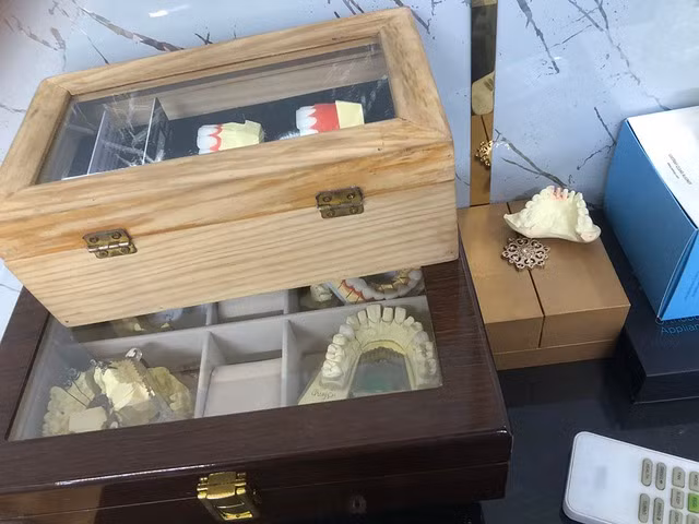 Mẫu răng sứ tại phòng khám nha khoa T.Đ ở đường Lạc Long Quân, P.10, Q.Tân Bình