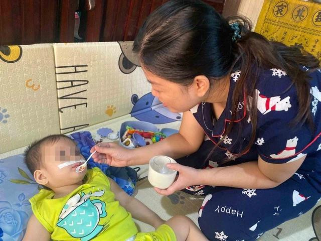 Mẹ con Mon ở nhà, bé phải đặt ống sonde để ăn và khó vận động do thường xuyên bị ói Mẹ con Mon ở nhà, bé phải đặt ống sonde để ăn và khó vận động do thường xuyên bị ói