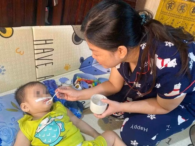 Mẹ con Mon ở nhà, bé phải đặt ống sonde để ăn và khó vận động do thường xuyên bị ói