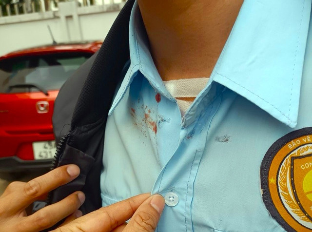 Nhân viên ngân hàng bị Trung dùng súng bắn sượt qua ngực.