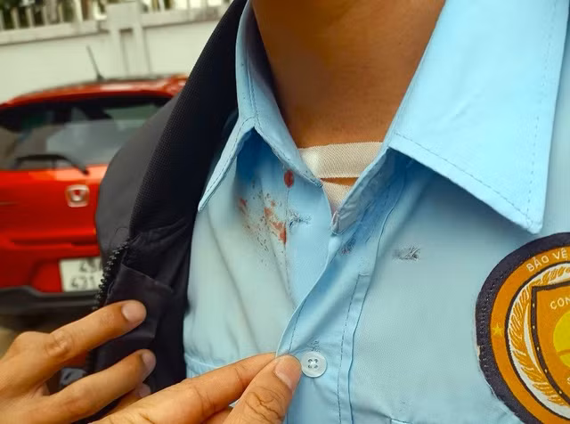 Nhân viên ngân hàng bị Trung dùng súng bắn sượt qua ngực.