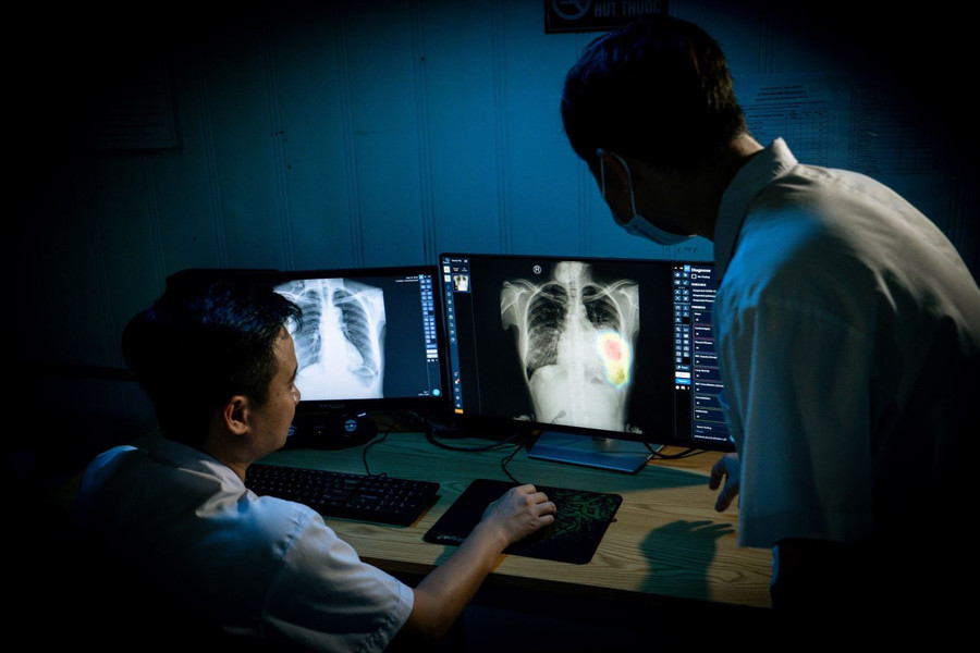 Sử dụng công nghệ AI trong chẩn đoán hình ảnh.