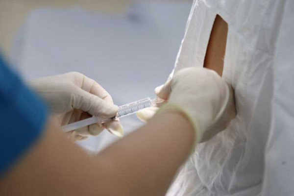 Gây tê khu vực thực hiện vết mổ trên bụng thai phụ. Gây tê khu vực thực hiện vết mổ trên bụng thai phụ.