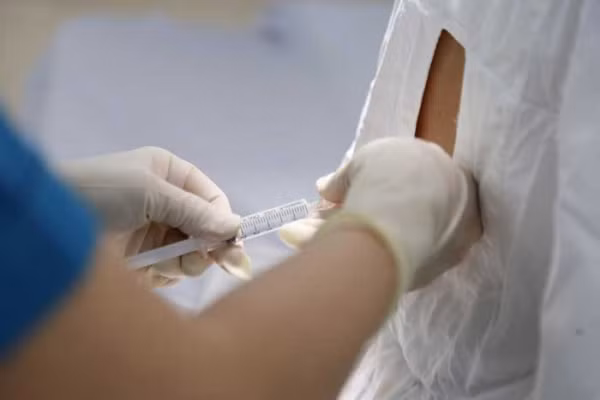 Gây tê khu vực thực hiện vết mổ trên bụng thai phụ.