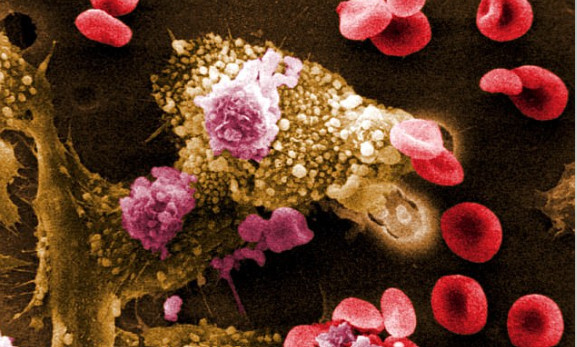 Hôm 23-2, Cơ quan Quản lý Thực phẩm và Dược phẩm Mỹ (FDA) đã cấp giấy chứng nhận vắc xin điều trị khối u ác tính của Moderna là &quot;đột phá&quot; - nghĩa là nó có thể được phê duyệt trong vài tháng tới. Minh họa: Shutterstock