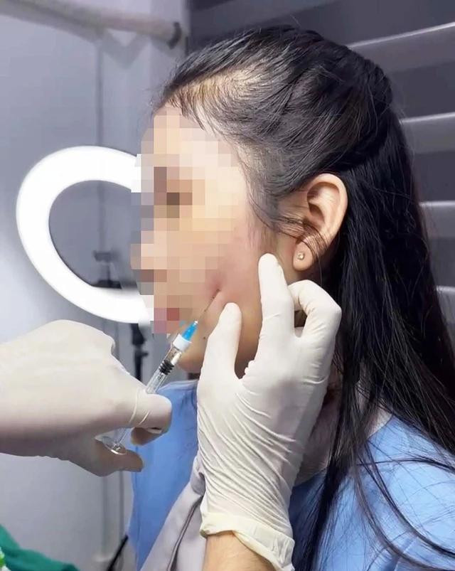 Tiêm filler ở một cơ sở thẩm mỹ “chui”