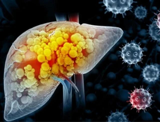 Tiêm một liều duy nhất vắc xin phòng bệnh lao có khả năng kích hoạt hệ thống miễn dịch của cơ thể và thu nhỏ khối u ung thư gan Tiêm một liều duy nhất vắc xin phòng bệnh lao có khả năng kích hoạt hệ thống miễn dịch của cơ thể và thu nhỏ khối u ung thư gan