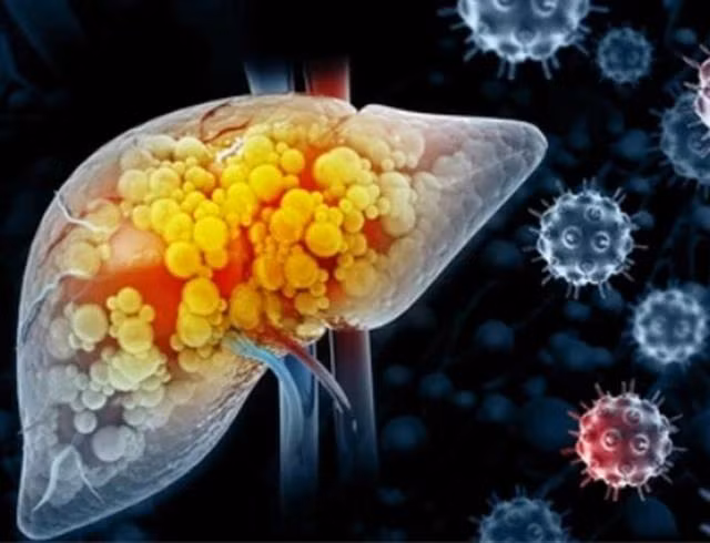 Tiêm một liều duy nhất vắc xin phòng bệnh lao có khả năng kích hoạt hệ thống miễn dịch của cơ thể và thu nhỏ khối u ung thư gan