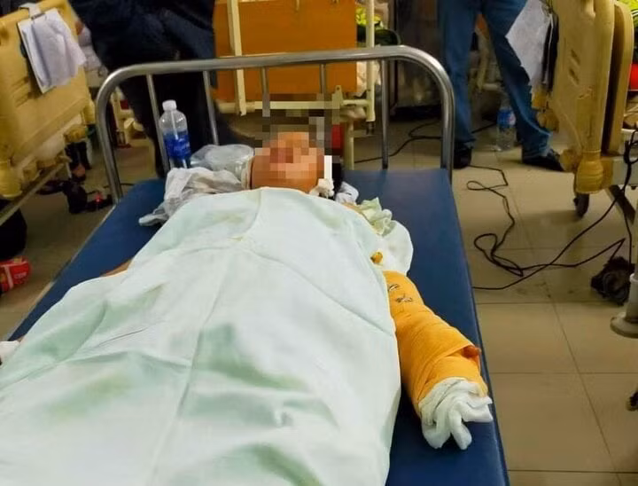 Nạn nhân được cấp cứu tại bệnh viện. (Ảnh: CTV)