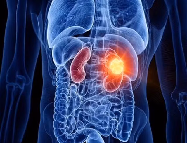 Phương pháp mới này có thể tiêu diệt cả những loại ung thư không thể điều trị