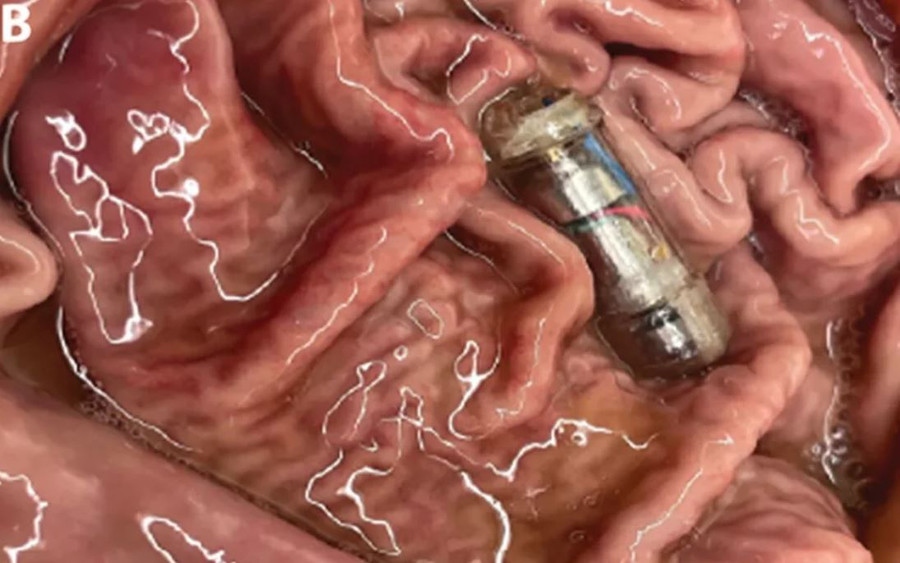 Viên nang VIBES sẽ hoạt động khi tiếp xúc với dịch dạ dày. Ảnh: Oddity Central