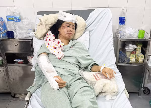 Chị Nguyễn Thị Kim chấn thương nặng khi bị lũ quét kinh hoàng