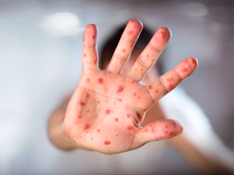 Ảnh: Internet Ảnh: Internet