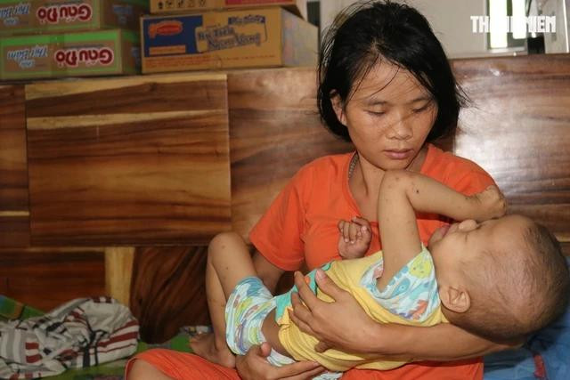 Mới 3 tuổi, Khoa đã liên tục trải qua các đợt hóa trị. Mỗi lần con khóc vì đau đớn, chị Ngọc chỉ biết vỗ về mong sao con bớt đau Mới 3 tuổi, Khoa đã liên tục trải qua các đợt hóa trị. Mỗi lần con khóc vì đau đớn, chị Ngọc chỉ biết vỗ về mong sao con bớt đau