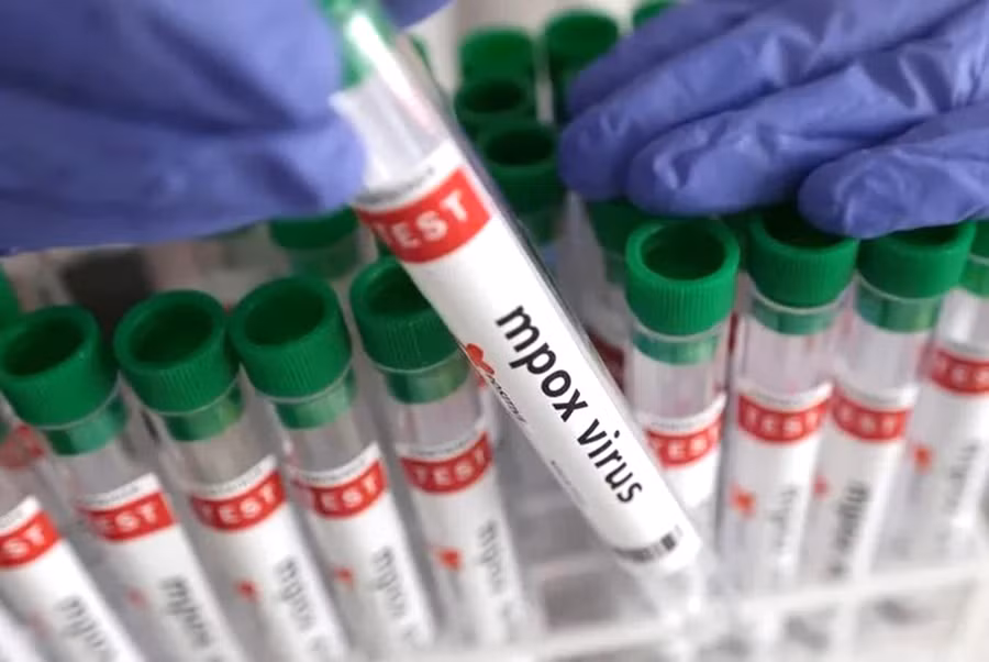 Các mẫu xét nghiệm tìm vi rút gây ra bệnh đậu mùa khỉ. Ảnh: Reuters