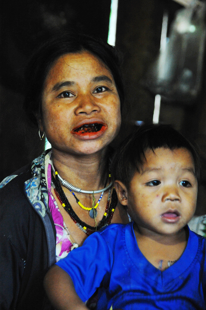 Ảnh: Nguyễn Giác