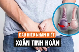 Lưu ý thời gian vàng để cứu tinh hoàn bị xoắn