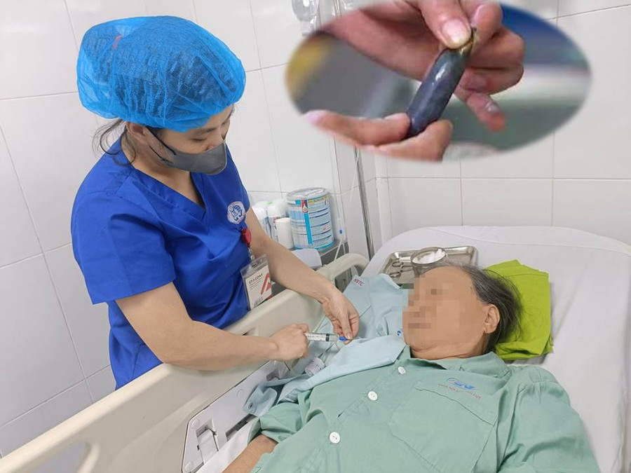 Người phụ nữ nguy kịch vì ăn mật cá cho... bổ mắt