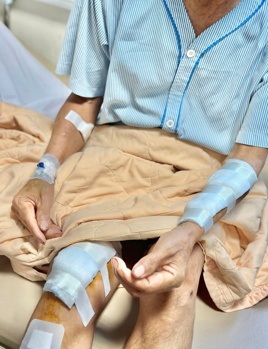 Ông Đ.V. (SN 1959, huyện Chư Prông, tỉnh Gia Lai) bị con trai mắc bệnh tâm thần tấn công gây đa chấn thương và hiện qua điều trị đã ổn định sức khỏe. Ảnh: ĐVCC z6700350860245-317ce29080bde56cdd6f1fd4e620df9c.jpg
