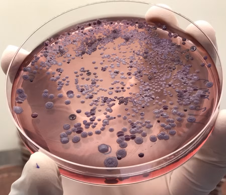 burkholderia-pseudomallei-colonies-isolated-from-soil-in-thailand.jpg