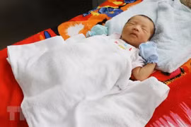 Cứu sống bé 3 ngày tuổi bị vàng da nặng bằng cách thay máu