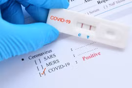 Phát hiện cách tiêu diệt 99,9% SARS-CoV-2 trong phổi