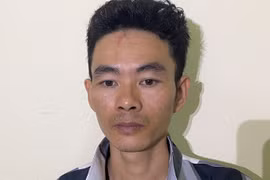Con rể dùng búa đinh đánh bố vợ tổn hại 41% sức khỏe vì mâu thuẫn đặt tên
