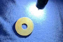 Gắp bu lông trong dạ dày cháu bé 5 tuổi